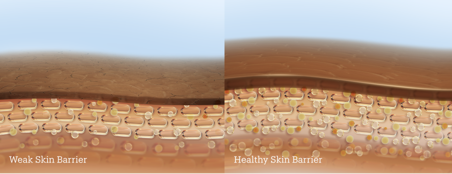 healthy vs unhealthy skin barrier illustration