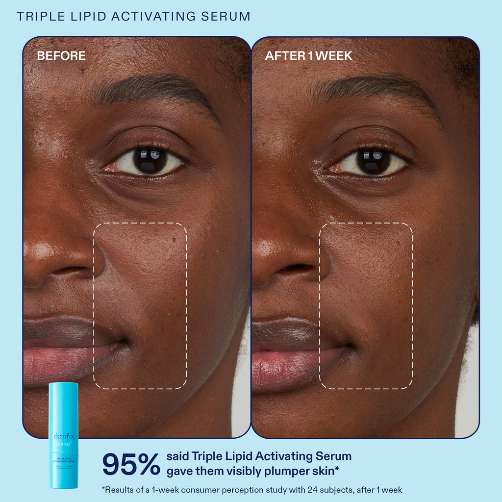 Skin Barrier Repair Products For Damaged Skin | Skinfix – Skinfix USA