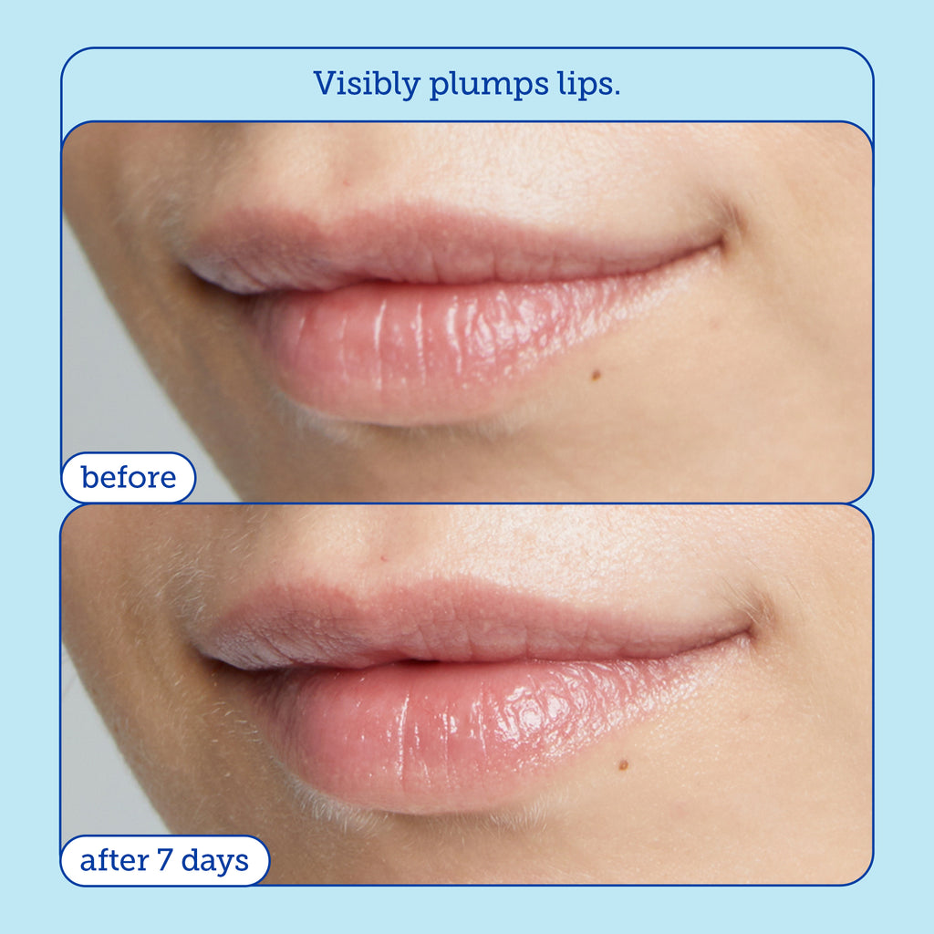 Barrier+ Triple Lipid + Collagen Lip Treatment  before and after