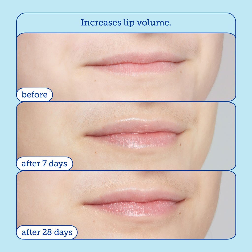 Barrier+ Triple Lipid + Collagen Lip Treatment  before and after