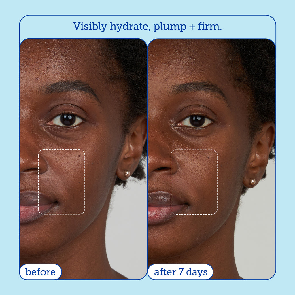 Skin Barrier Products to Repair Damaged Skin Barrier – Skinfix USA