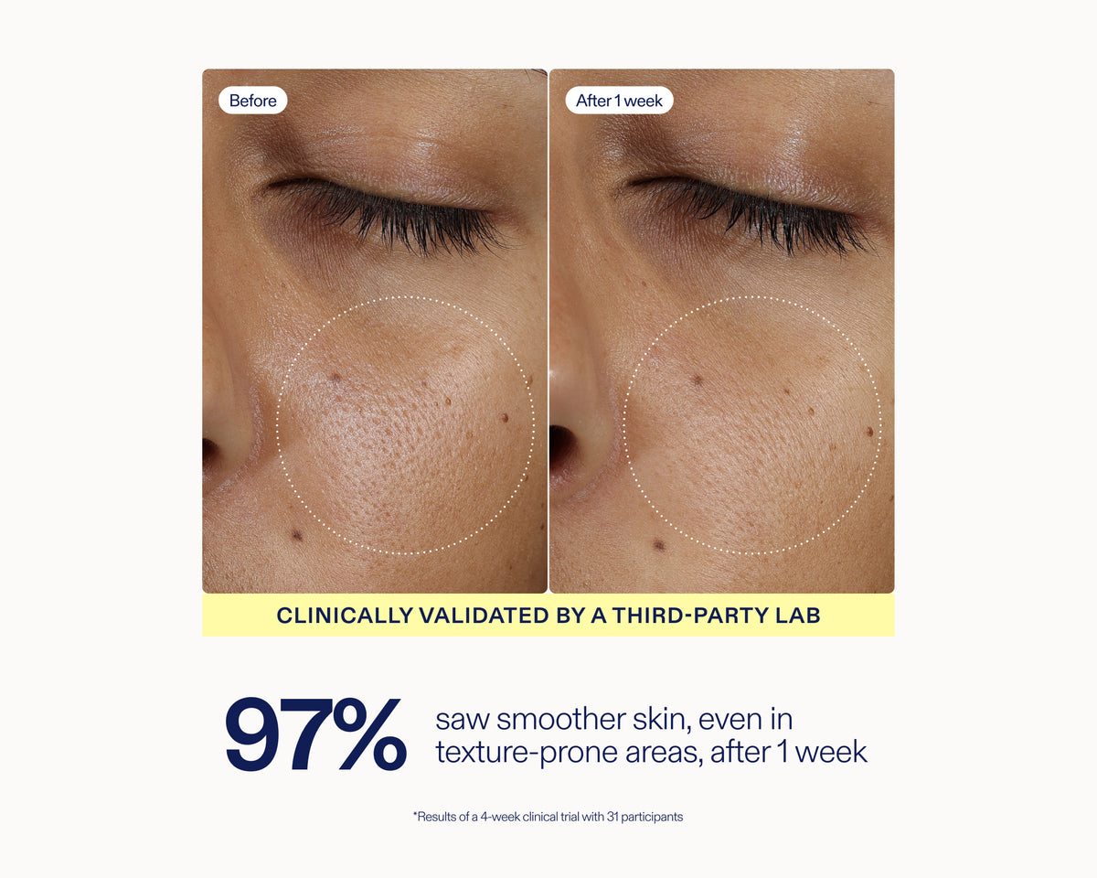 Before-and-after skin texture comparison on a person's cheek, showing visible improvement after one week. The graphic includes text stating 'Clinically validated by a third-party lab' and '97% saw smoother skin, even in texture-prone areas, after 1 week.