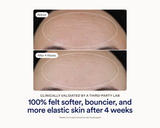 Stacked before and after clinical photos showing visibly smoother, more elastic skin on the forehead after 4 weeks of using Skinfix Ceramide Prime Whipped Cream, with text reading: Clinically validated by a third-party lab — 100% felt softer, bouncier, and more elastic skin after 4 weeks.