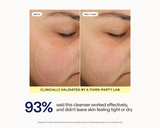 Before and after comparison of facial skin clarity on a person's cheek, with text stating 'Clinically validated by a third-party lab' and '93% said this cleanser worked effectively, and didn't leave skin feeling tight or dry'.