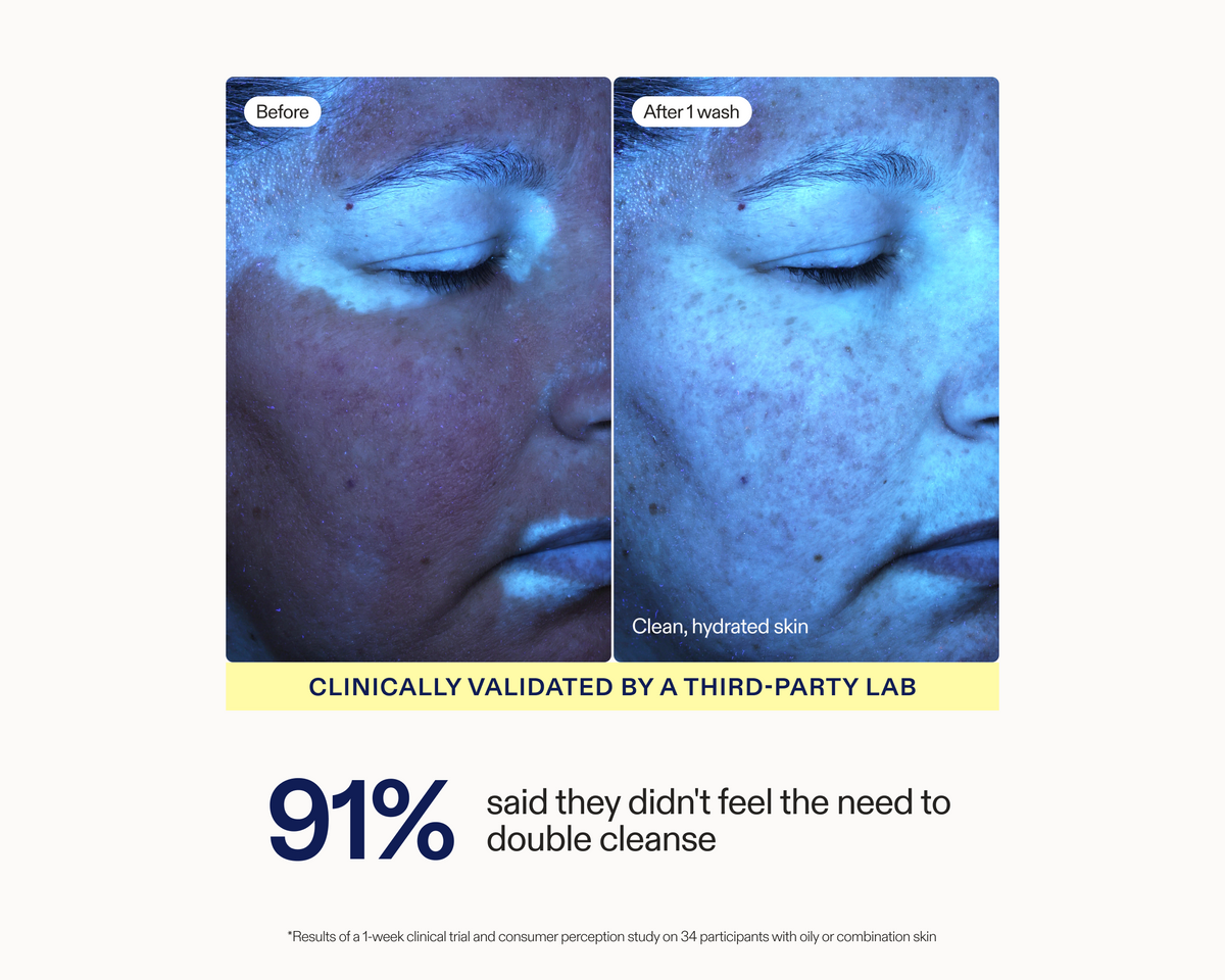 Before and after comparison of facial skin showing a double cleanse routine result. The left panel labeled 'Before' shows a close-up of a person's face with a thick white cream or balm on the cheek.