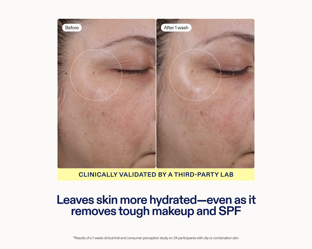 Before and after image results with text "CLINICALLY VALIDATED BY A THIRD PART LAB Leaves skin more hydrated–even as it removes tough makeup and SPF".
