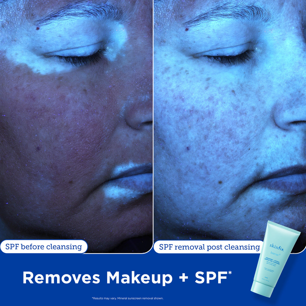 Skin Barrier Products to Repair Damaged Skin Barrier – Skinfix USA