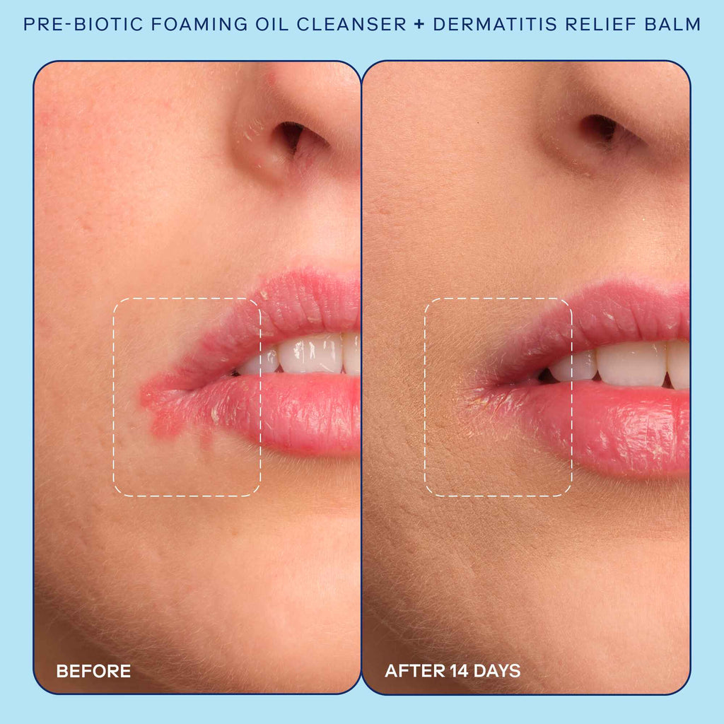 Pre-Biotic Foaming Oil Cleanser before and after