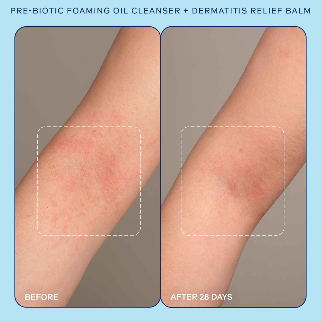 Pre-Biotic Foaming Oil Cleanser before and after