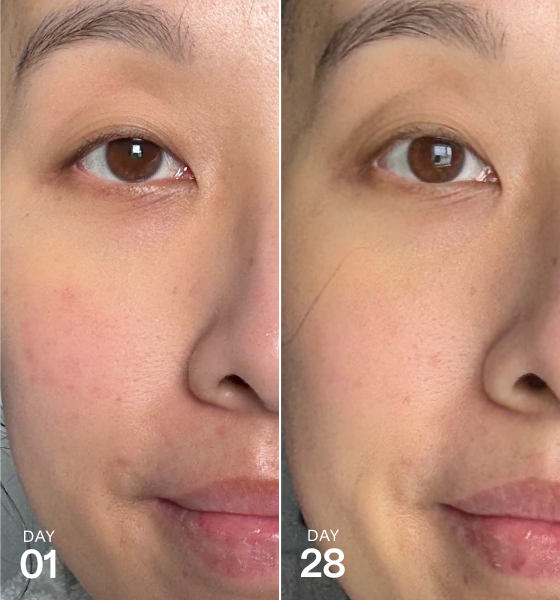 Side-by-side close-up of a person’s face on Day 01 and Day 28, showing changes in overall skin tone and appearance.
