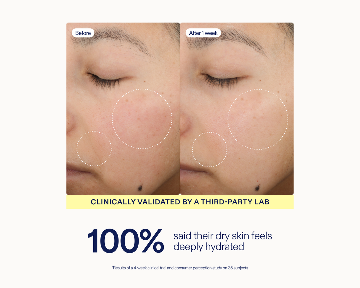 Triple Lipid-Peptide Cream | Skinfix – Skinfix USA