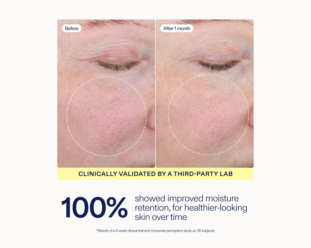 Before-and-after skin comparison showing the cheek area of a person's eye, labeled 'Before' and 'After 1 month,' with text below stating '100% showed improved moisture retention, for healthier-looking skin over time.'.