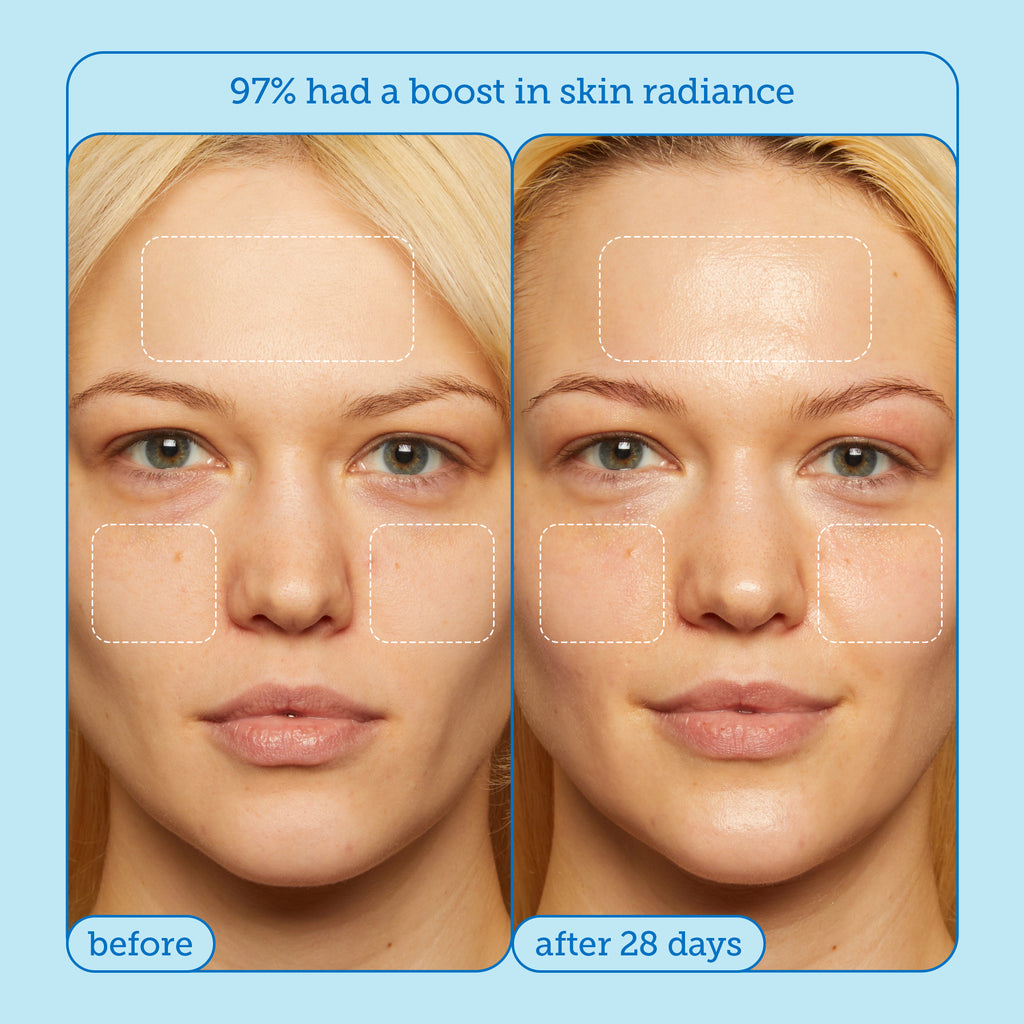 Skin Barrier Products to Repair Damaged Skin Barrier – Skinfix USA