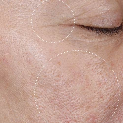 Close-up of a person's face with improved texture and firmer skin