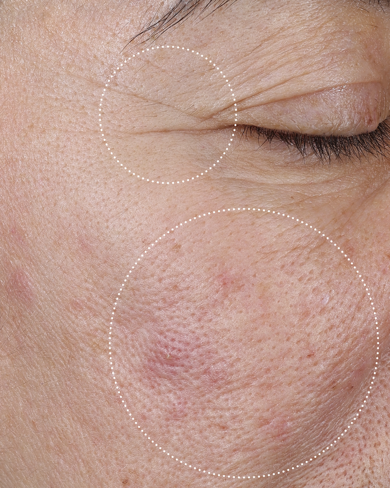 Close-up of an person's face with wrinkles and skin texture highlighted.