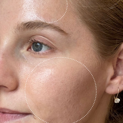 Close-up of a person's face with visibly less texture and brighter skin