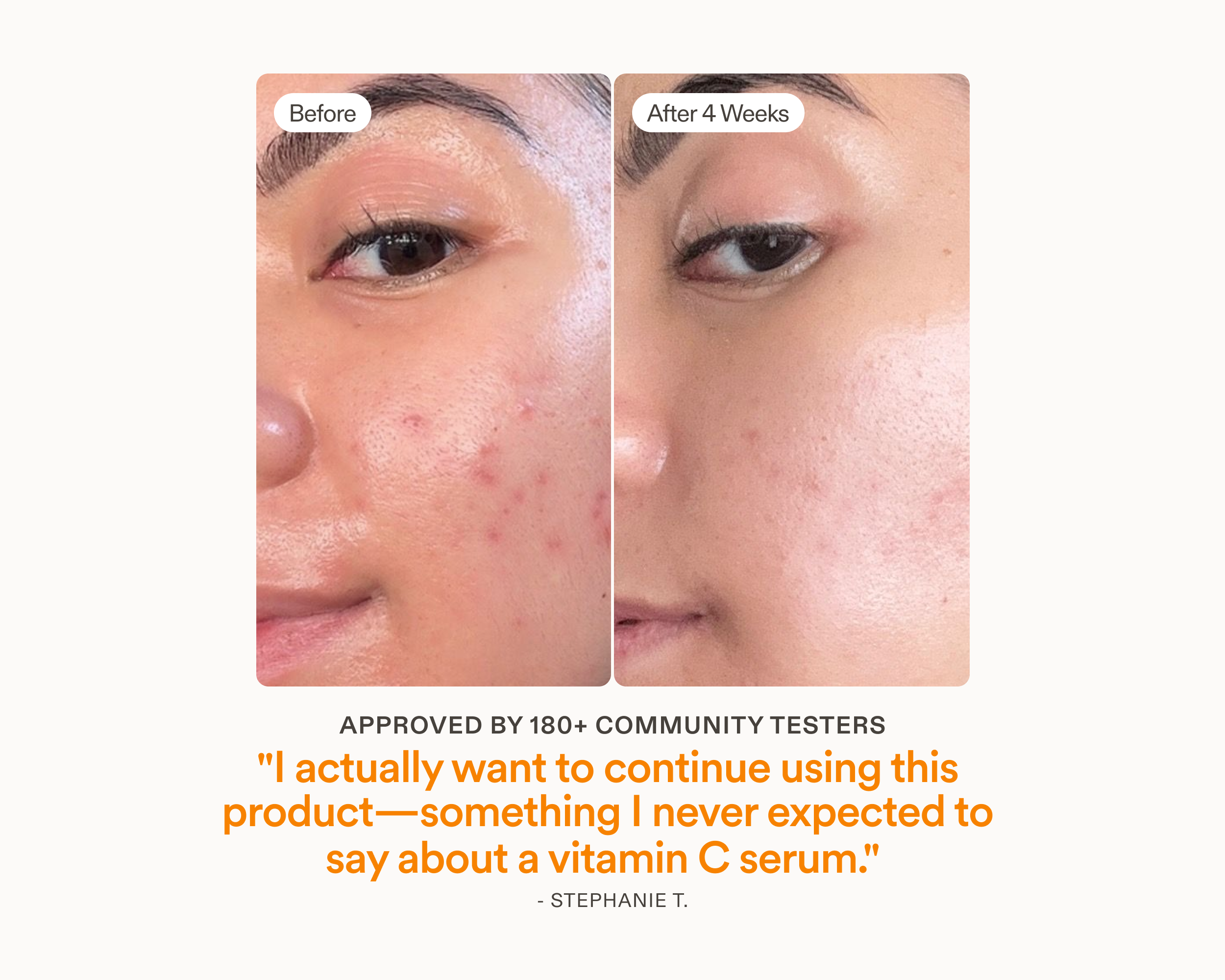 Before and after comparison of a face with blemishes, showing improvement over 4 weeks after using vitamin c serum.