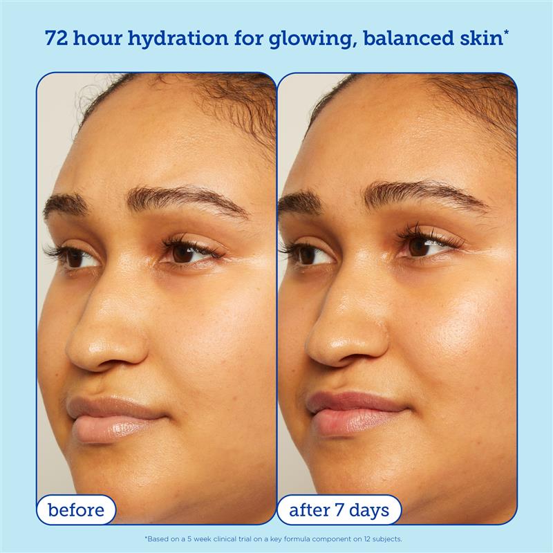 Barrier+ Skin Barrier Restoring Gel Cream before and after