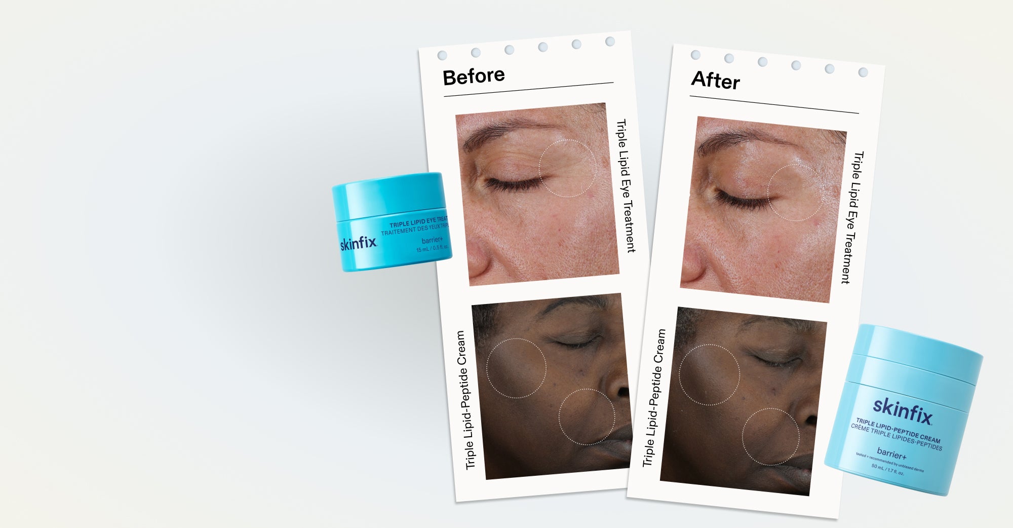 Triple Lipid Eye Treatment and Triple Lipid-Peptide Cream displayed alongside side-by-side before and after clinical photos showing visibly smoother skin around the eye area and cheek for two participants.