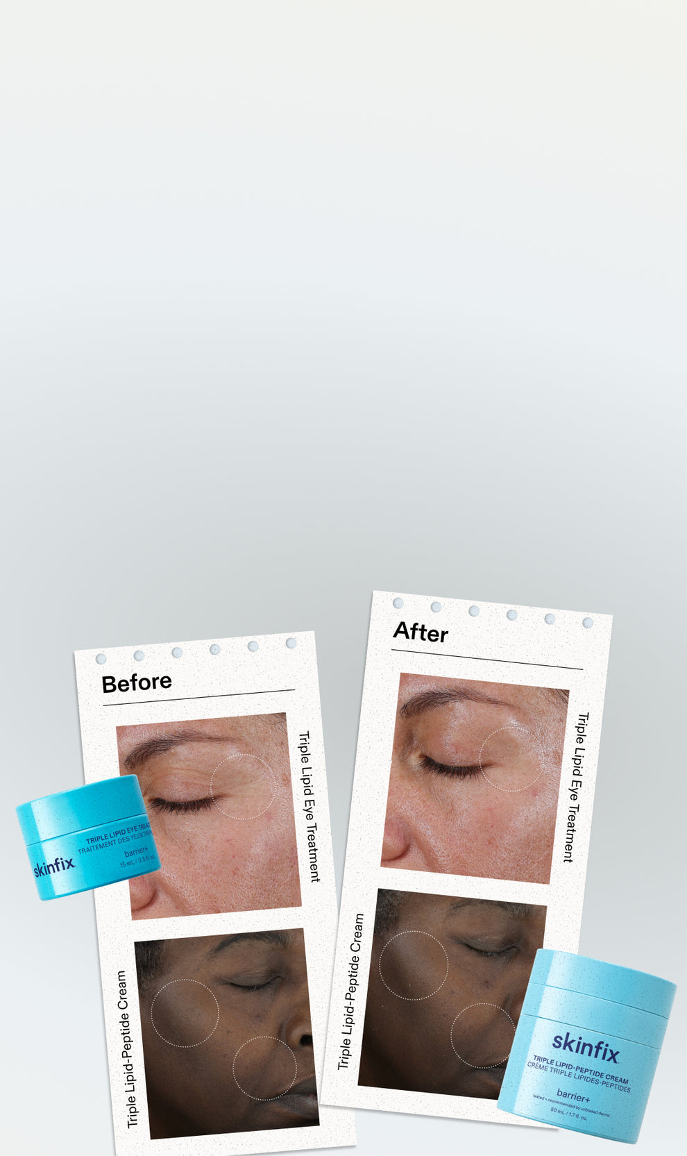 Triple Lipid Eye Treatment and Triple Lipid-Peptide Cream displayed alongside side-by-side before and after clinical photos showing visibly smoother skin around the eye area and cheek for two participants.