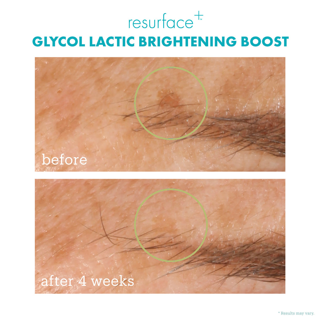 glycol lactic bright before + after