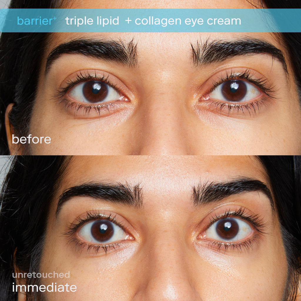 Triple Lipid + Collagen Eye Treatment Active  Before and Immediate